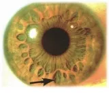 Lezing Spirituele iriscopie